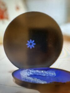 透明マウスピース矯正